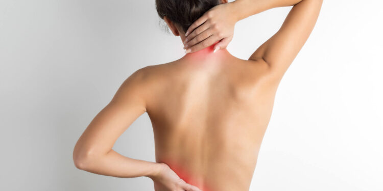 Escoliose é mais frequente nas mulheres