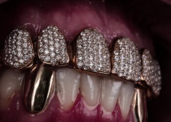 De grillz a piercings: especialista explica cuidados necessários com acessórios bucais