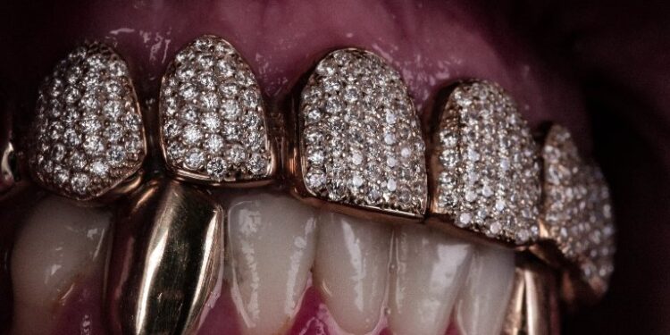 De grillz a piercings: especialista explica cuidados necessários com acessórios bucais