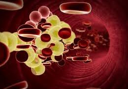 Saiba como combater o colesterol alto, doença que acomete 4 em cada 10 brasileiros       