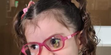 Pais precisam estar atentos ao comportamento visual dos filhos, alerta especialista